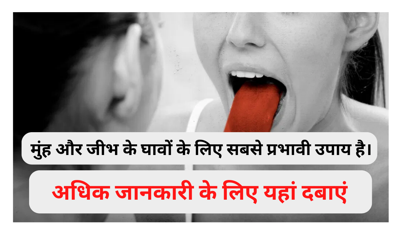 This is the most effective remedy for any kind of mouth and tongue sores.